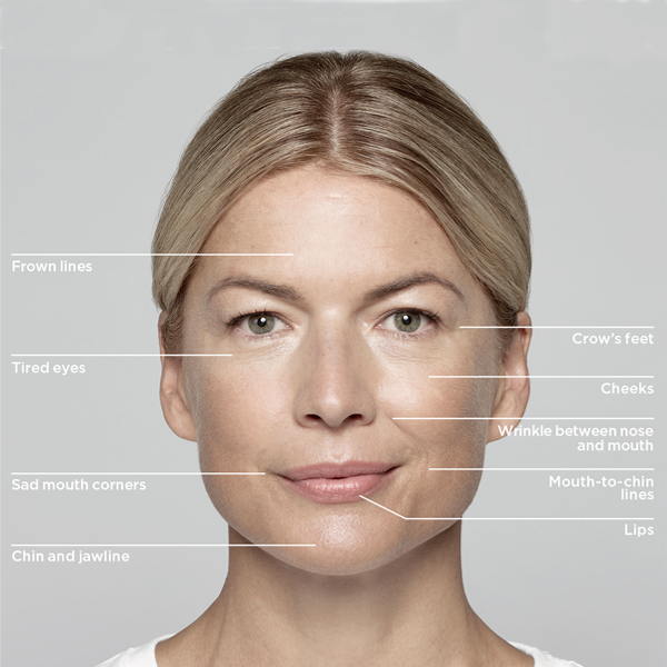 Fillers Dermal Fillers - Image 1