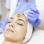Medical Peels